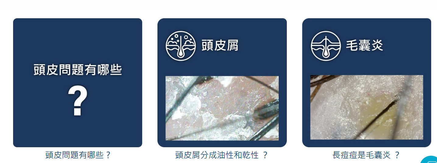 頭皮問題有哪些、頭皮屑、毛囊炎高清圖